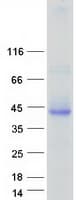 Human ASGR1 / ASGPR Protein (Recombinant Myc-DDK (Flag))