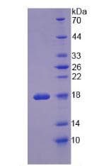 Human Ribonuclease A / RNASE1 Protein (Recombinant His, N-Terminal)
