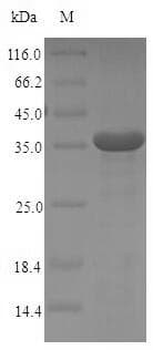 Human FcERI / Fc Epsilon RI Protein (Recombinant 6His-SUMO, N-terminus)