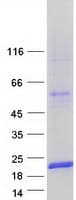 Human LGALS7 / Galectin 7 Protein (Recombinant Myc-DDK (Flag))