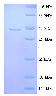 Sheep IL6 / Interleukin 6 Protein (Recombinant His)