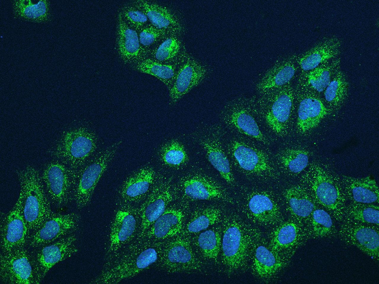 Polyclonal Rabbit anti-Human FBXL12 Antibody (IF)