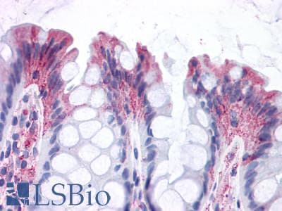PathPlus™ GPR82 Antibody (Cytoplasmic Domain)
