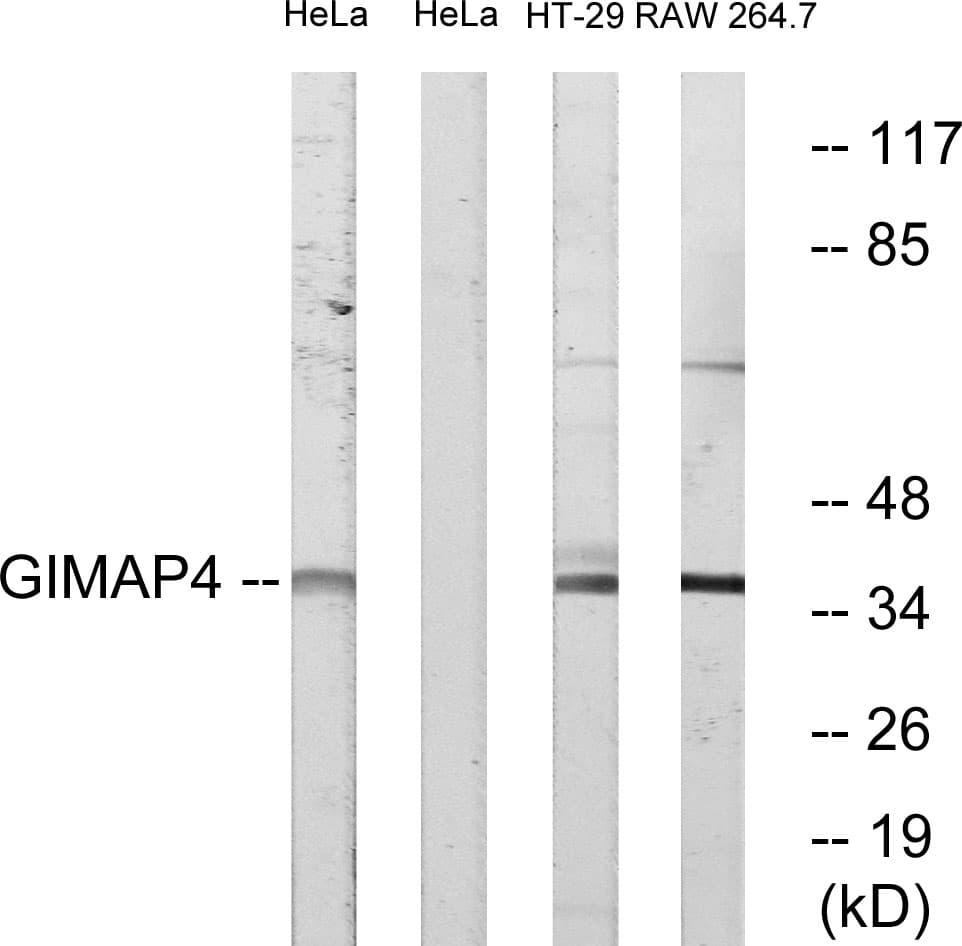 GIMAP4 Antibody (aa131-180)