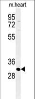 ATP4B Antibody (aa52-78)