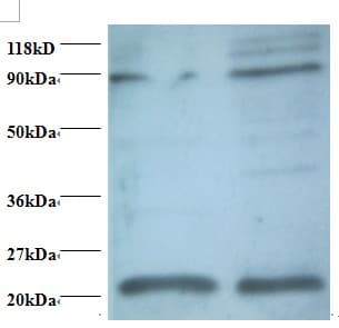 AP50 / AP2M1 Antibody (HRP)