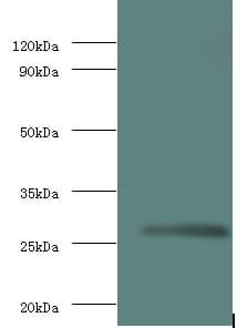 Rabies Virus Matrix Protein Antibody (FITC)
