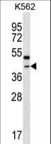 Polyclonal Rabbit anti-Human OR6Q1 Antibody (aa279-307, WB)