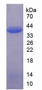 Human ASNS Protein (Recombinant His-T7)