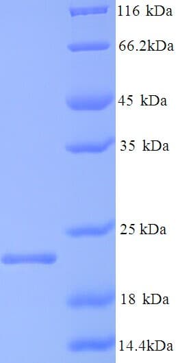 Hepatitis B Virus HBcAg / HBV Core Antigen Protein (Recombinant His)