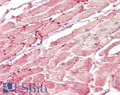 IHC-plus™ Monoclonal Mouse anti-Human PCMT1 Antibody (clone 4G9, IHC, WB)