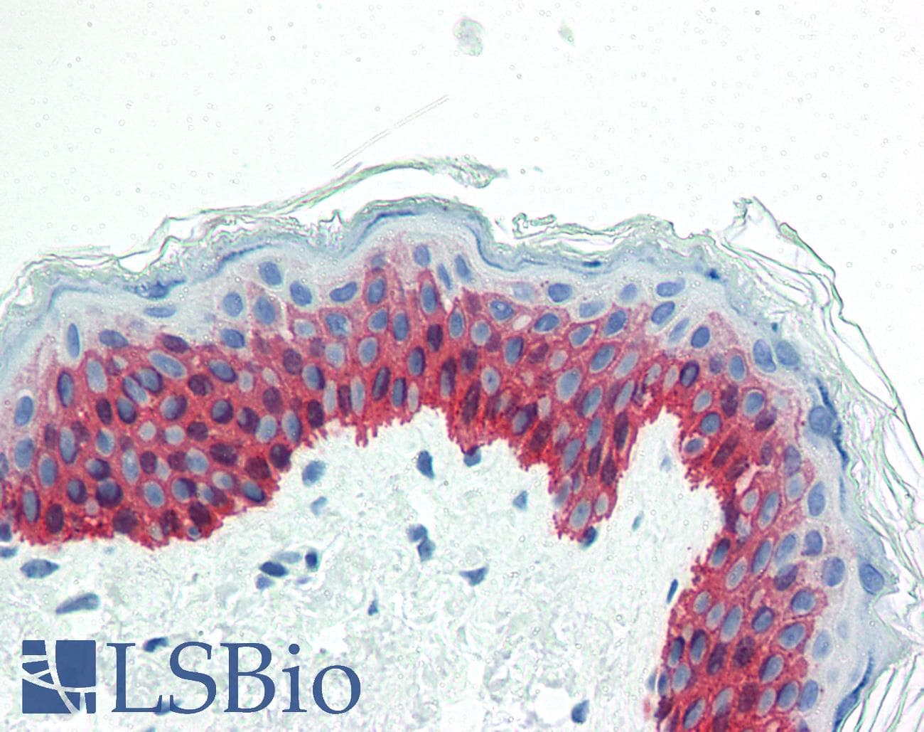 IHC-plus™ KRT14 / CK14 / Cytokeratin 14 Antibody (C-Terminus)