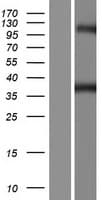 Human GTPBP10 Protein (Over-Expression Lysate Myc-DDK (Flag))