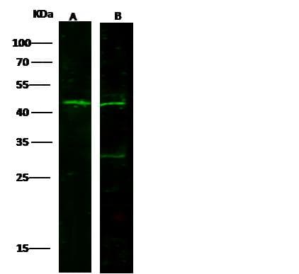 Polyclonal Rabbit anti-Mouse TIMD4 / TIM4 / TIM-4 Antibody (Preservative Free, WB)