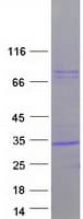 Human CFD / Factor D / Adipsin Protein (Recombinant Myc-DDK (Flag))