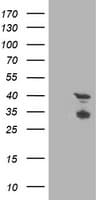 TMOD1 / Tropomodulin 1 Antibody (clone OTI4G9)