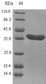 Magnaporthe oryzae SDH1 Protein (Recombinant 6His-SUMO, N-terminus)
