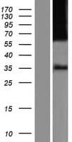 Human OPRM1 / Mu Opioid Receptor Protein (Over-Expression Lysate Myc-DDK (Flag))