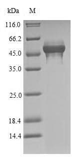Penaeus monodon Tropomyosin Protein (Recombinant 6His-SUMO, N-terminus)