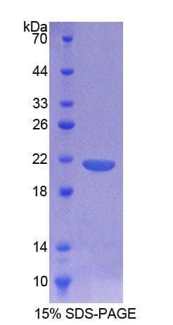 Rat CD164 Protein (Recombinant His-T7)