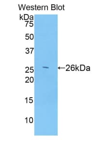 ADAMTS12 Antibody (aa1318-1538)