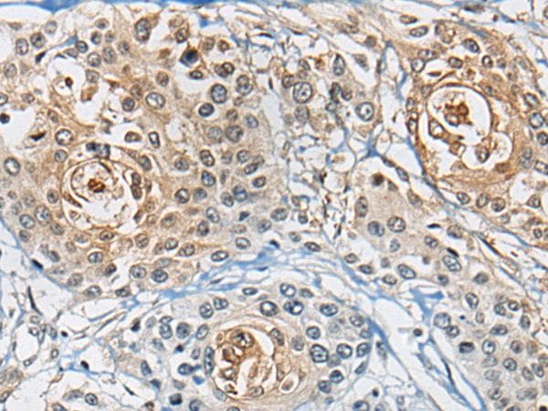 Polyclonal Rabbit anti-Human CD8A / CD8 Alpha Antibody (IHC)