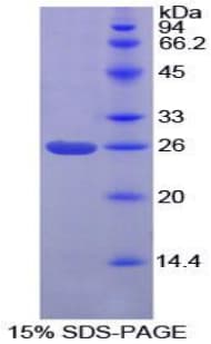 Mouse PICK1 Protein (Recombinant His-T7)