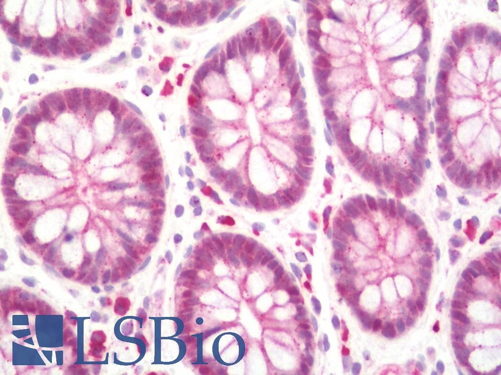 IHC-plus™ SHREW-1 / AJAP1 Antibody