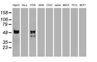 SERPINA1 / Alpha 1 Antitrypsin Antibody (clone OTI3C5)