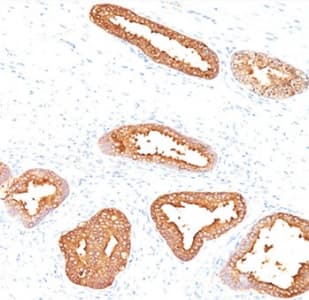 KLK3 / PSA Antibody (clone A67-B/E3, Ready-to-Use)
