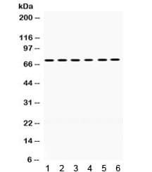 LIMK2 Antibody