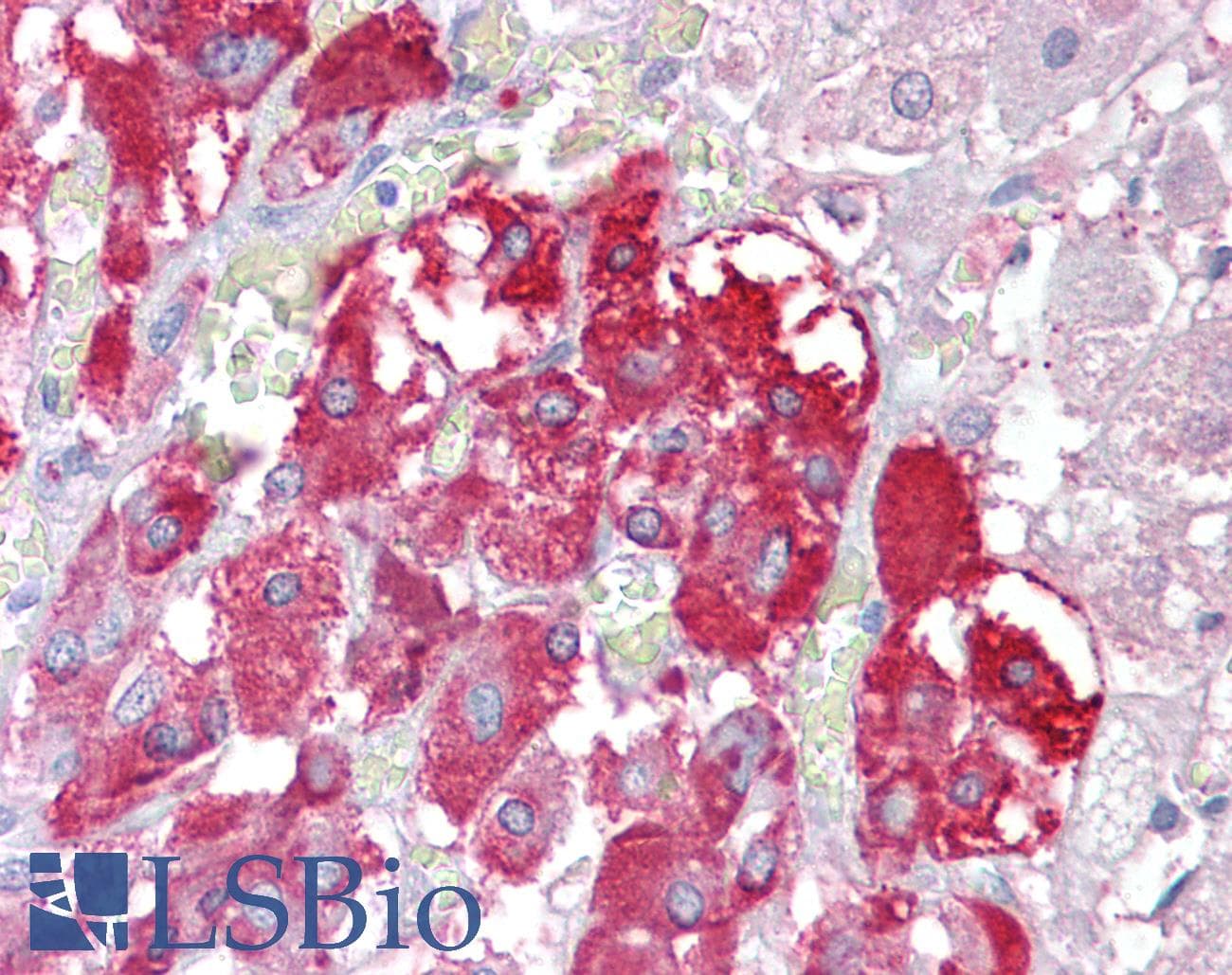 IHC-plus™ TPTE Antibody (aa371-383)