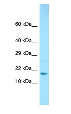 Polyclonal Rabbit anti-Human GMF Beta / GMFB Antibody (aa48-97, WB)