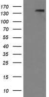PDGFRB / PDGFR Beta Antibody (clone OTI1D1)