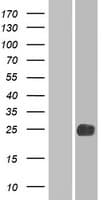 LHFPL2 Protein (Over-Expression Lysate Myc-DDK (Flag))