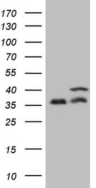 Monoclonal Mouse anti-Human PPP1CA / PP1-Alpha Antibody (clone OTI6E5, Carrier-free, IHC, WB)