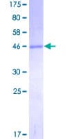 Human MGMT Protein (Recombinant GST)