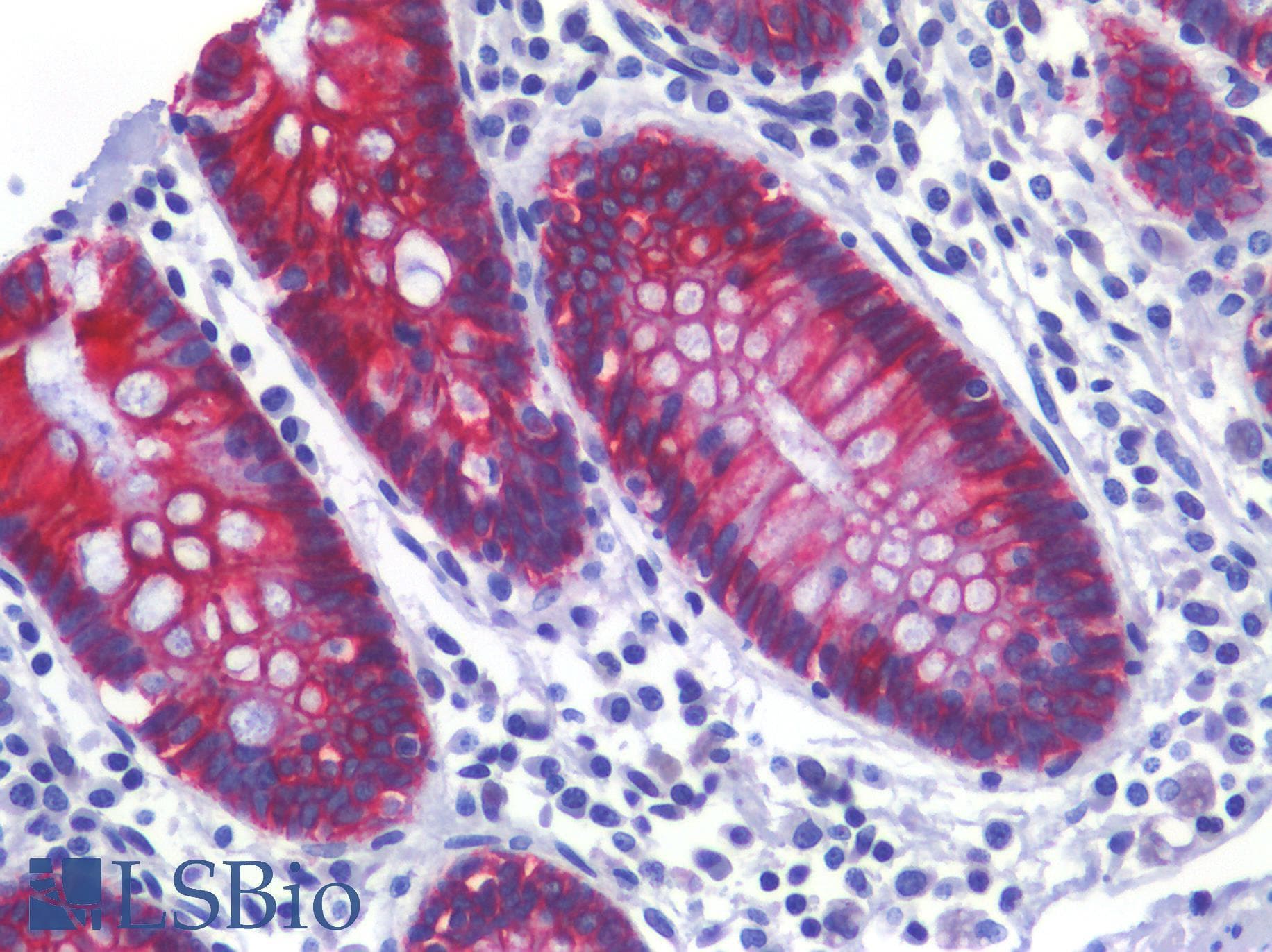 PathPlus™ CDH17 / Cadherin 17 Antibody (clone 1H3)