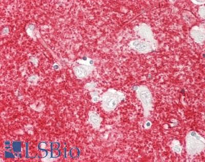 PathPlus™ Polyclonal Rabbit anti-Human SLC1A3 / EAAT1 Antibody (aa492-541, IHC, WB)