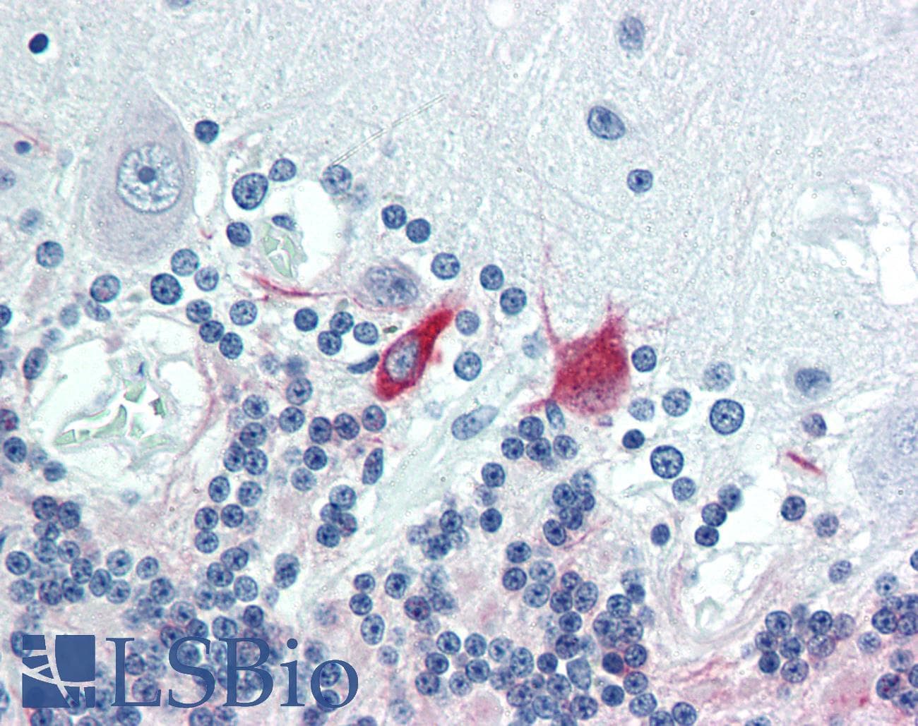 PathPlus™ MAP2 Antibody (clone 5F9)