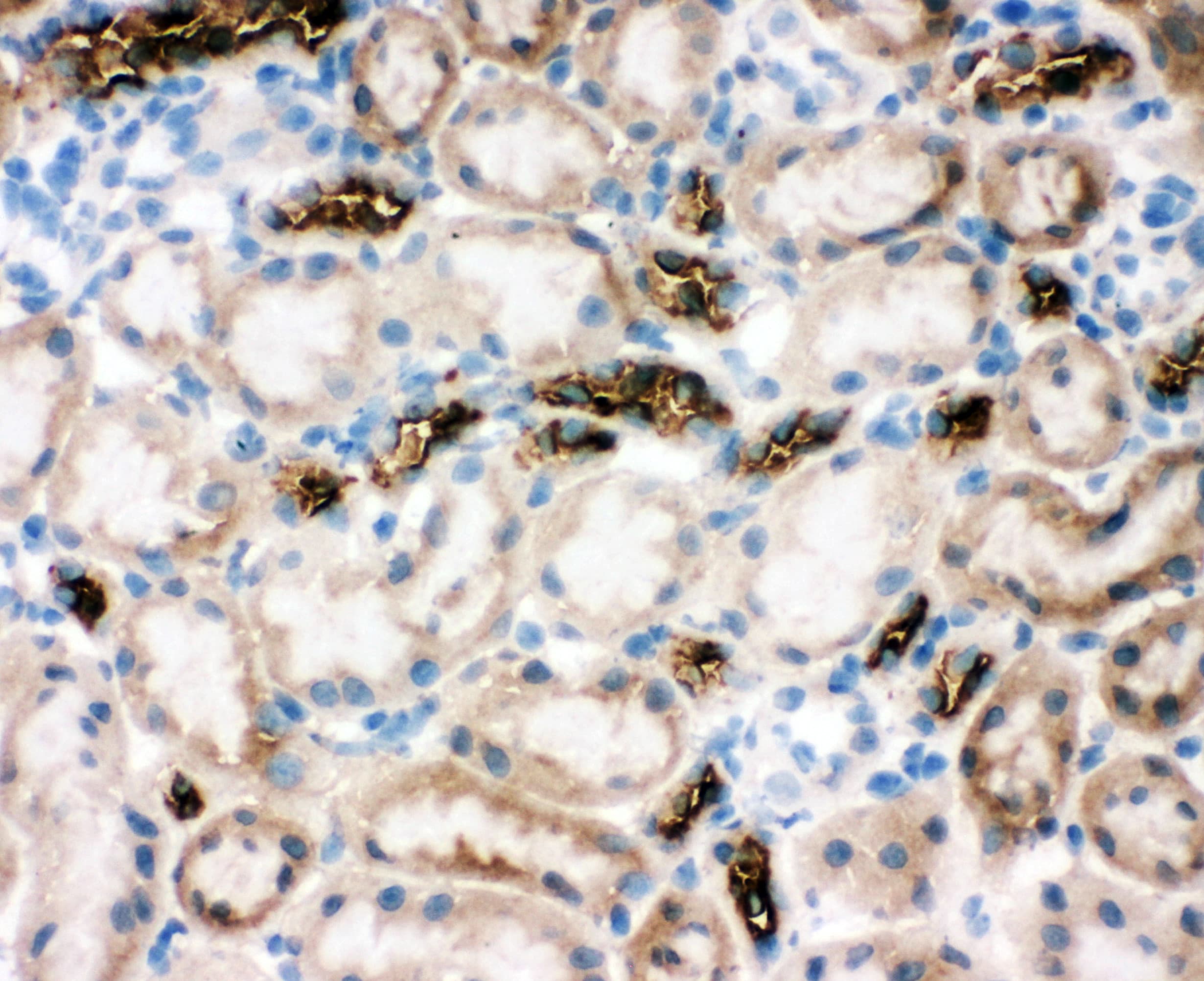 Polyclonal Rabbit anti-Human SLC12A1 / NKCC2 Antibody (aa125-139, IHC, WB)