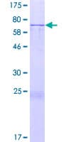 Human FJX1 Protein (Recombinant GST)