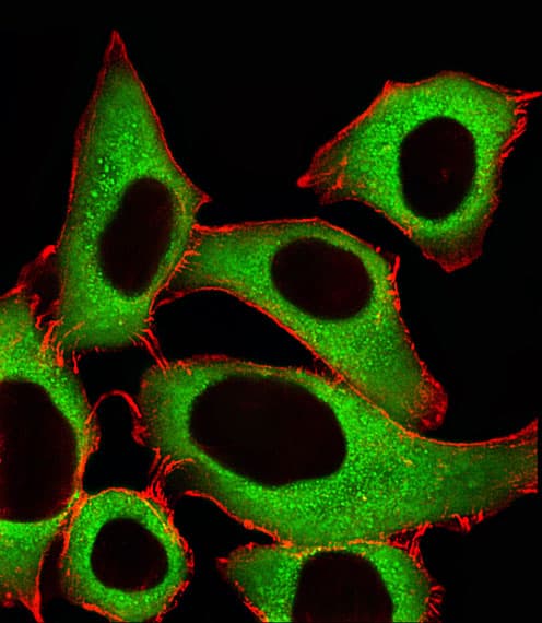ALDH1A1 / ALDH1 Antibody (aa306-339)