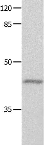 GNA11 Antibody