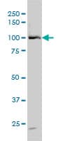 DP97 / DDX54 Antibody (clone 2H6)