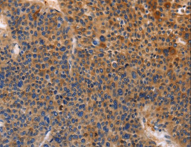 MUSK Antibody