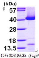 Human TALDO1 / Transaldolase 1 Protein (Recombinant His)