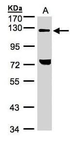 TACC2 Antibody (aa237-293)