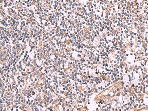 SLC12A5 / KCC2 Antibody