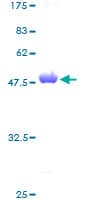 Human CRYAB / Alpha B Crystallin Protein (Recombinant GST)